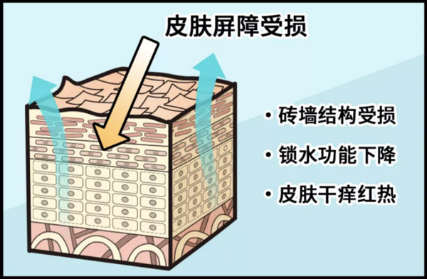 皮膚屏障受損后應該如何修護？